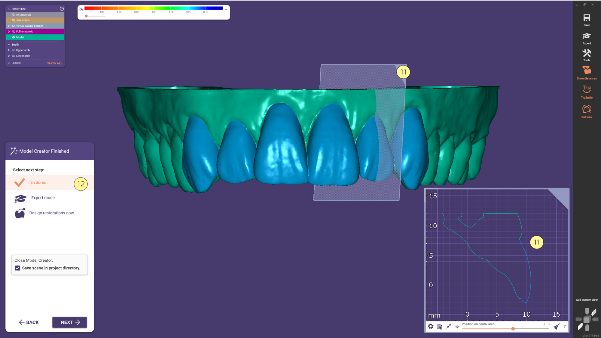 Mockup Model Exocad