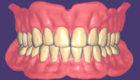 Conception de prothèses dentaires complètes