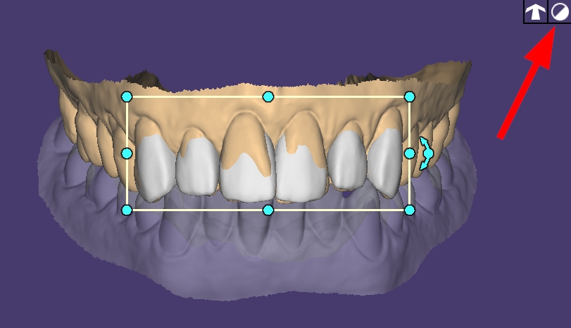 Full tooth view.jpeg