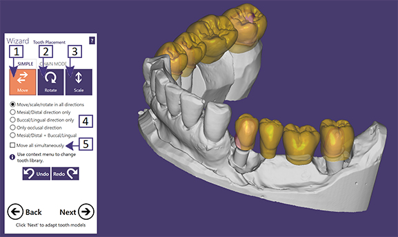 Tooth Placement -PIC.png