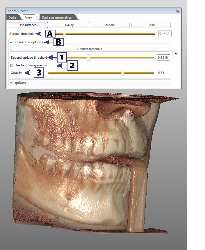 Dicom T3-Iso options transparancy1b.png