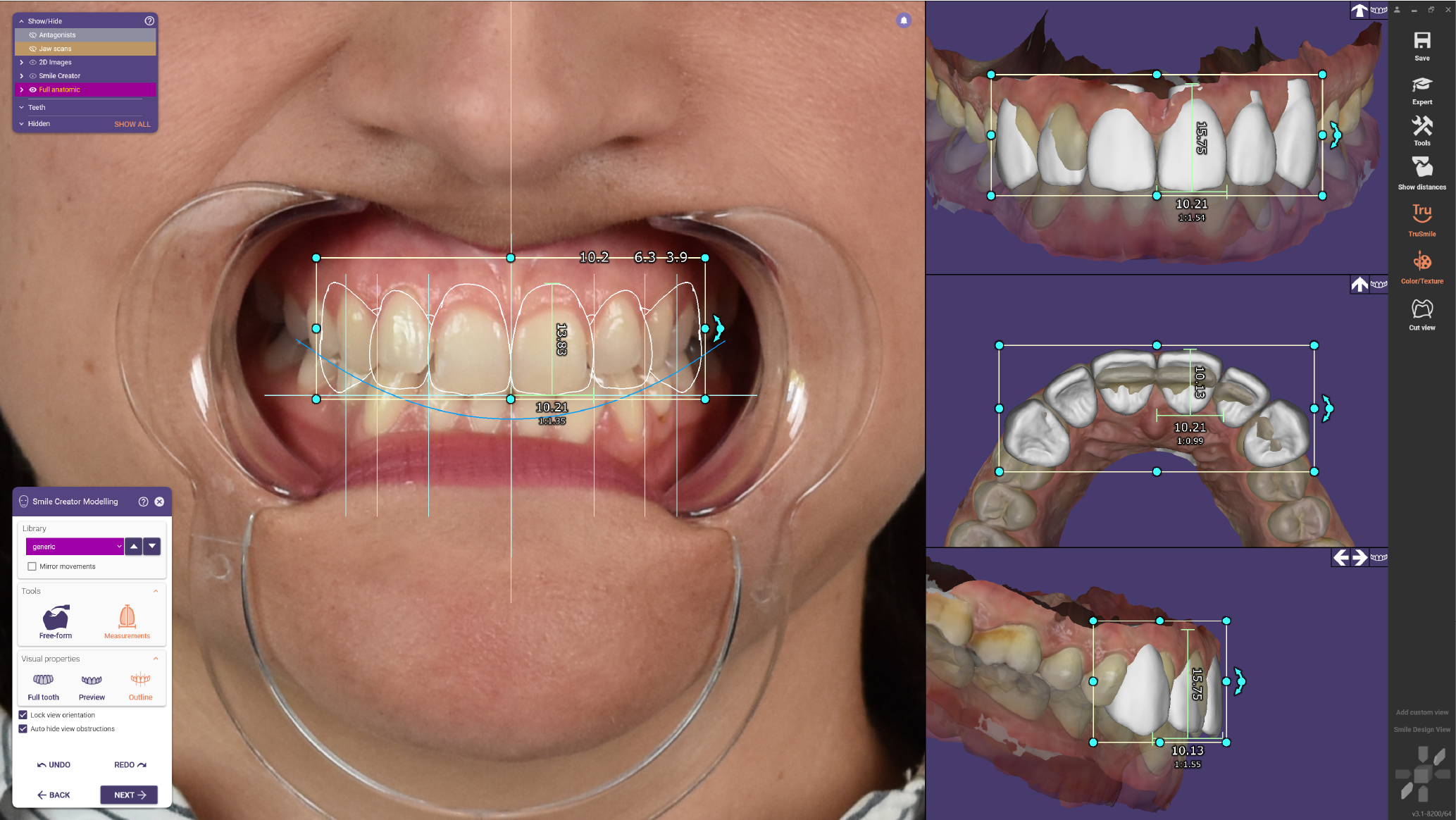 View the dimensions of a tooth 3.1.png