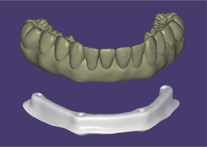 File:Split bar 3.3-0.png