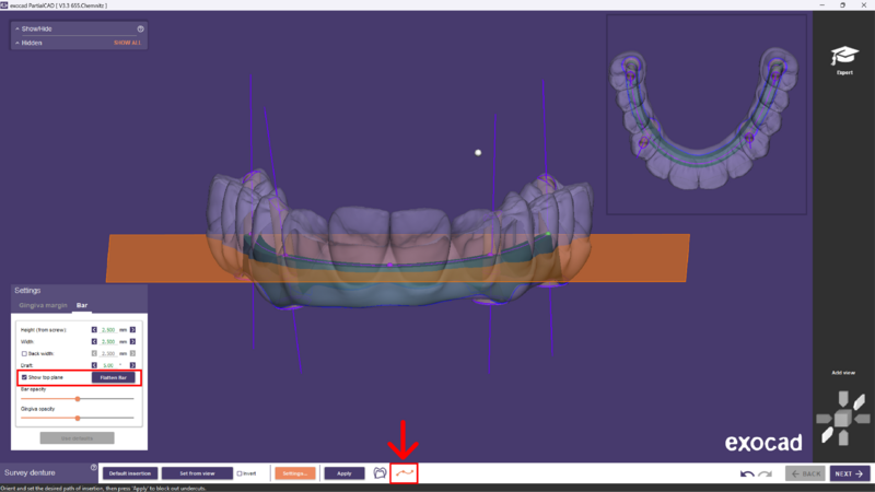 File:Split bar partial-10.png