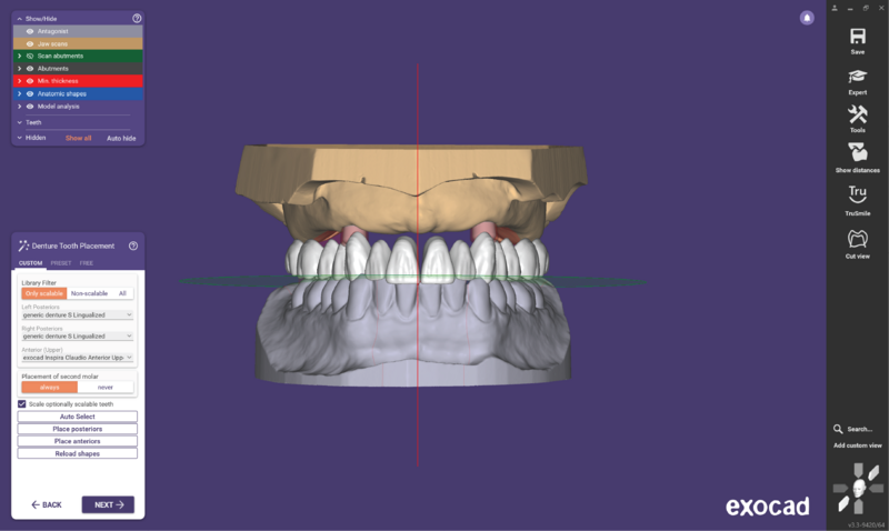 File:O ball attach 3.3-09.png
