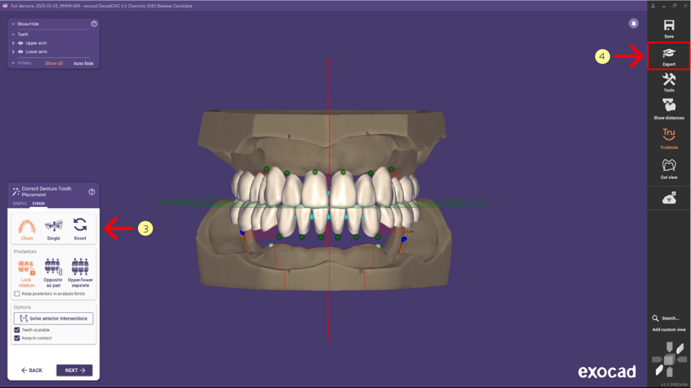 Denture remove teeth4-03 3.3.png