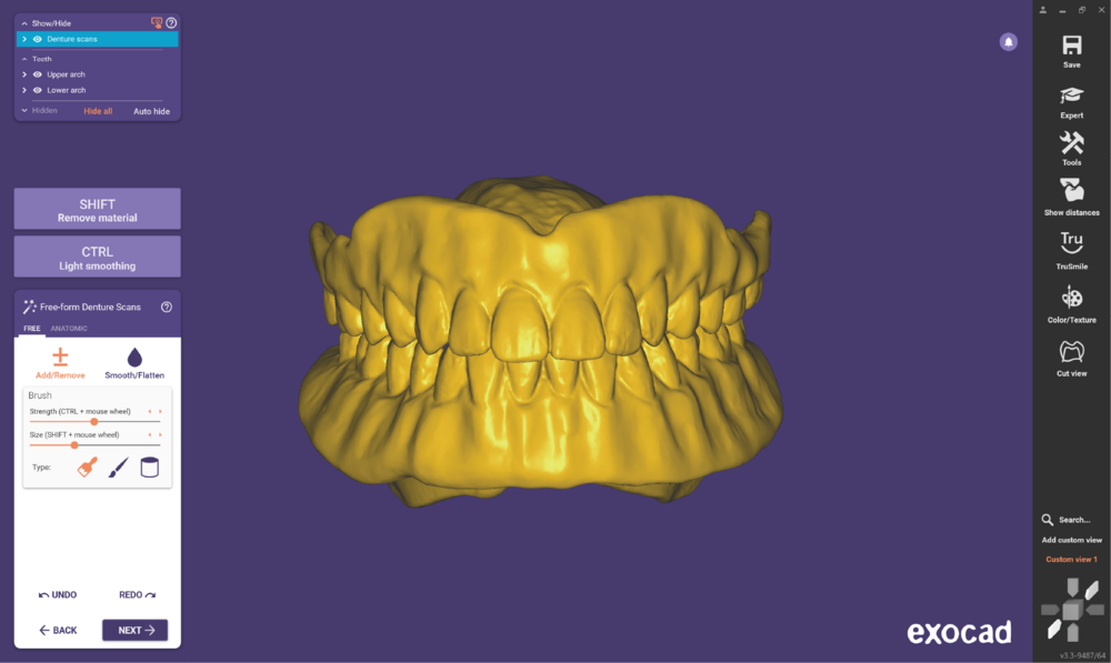 Duplicate denture3.3-04.png