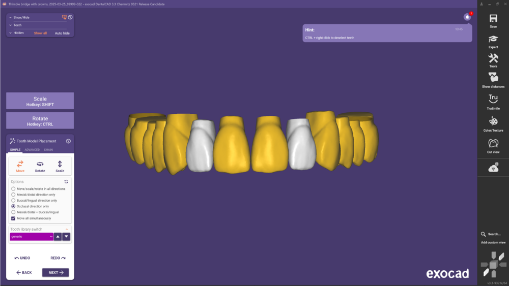 Tooth Model placement 3.3 8.png