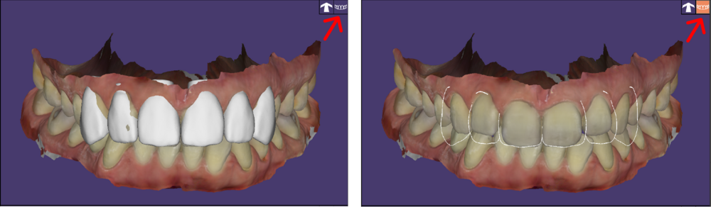 Full tooth viw 3.1.png