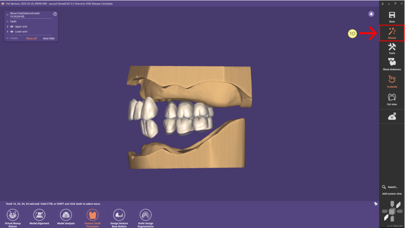 File:Denture remove teeth4-08 3.3.png