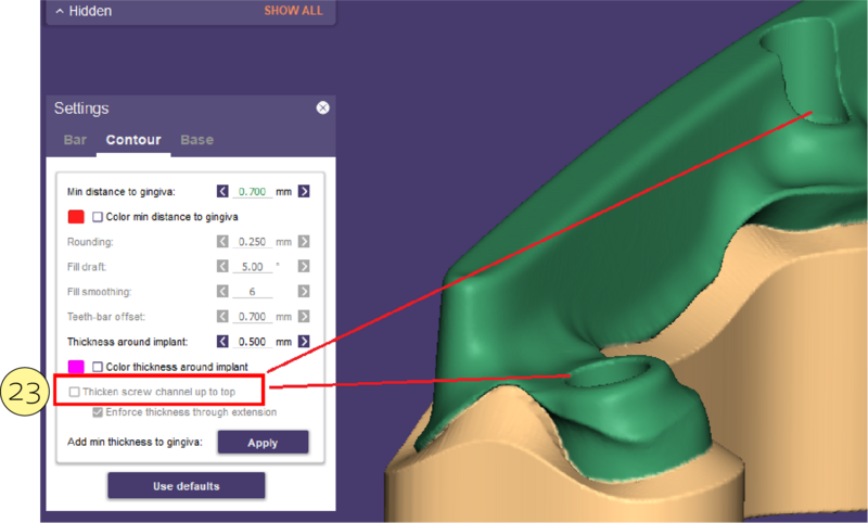 File:Split bar partial-21.png