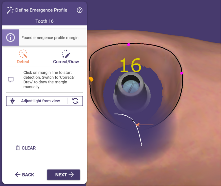File:Emergence profile 3.3 1.png