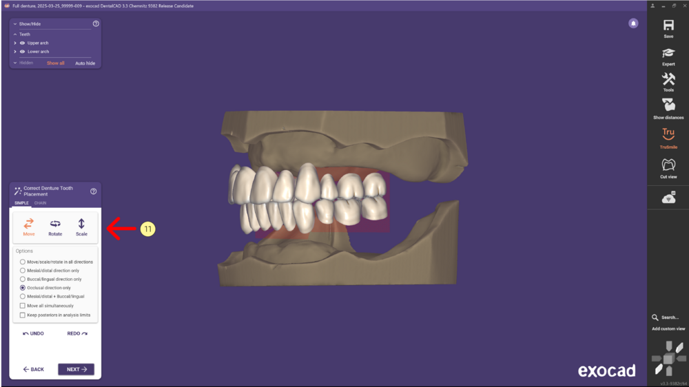 Denture remove teeth4-09 3.3.png