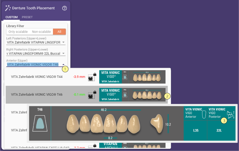 Denture Tooth Placement 1 3.1.png