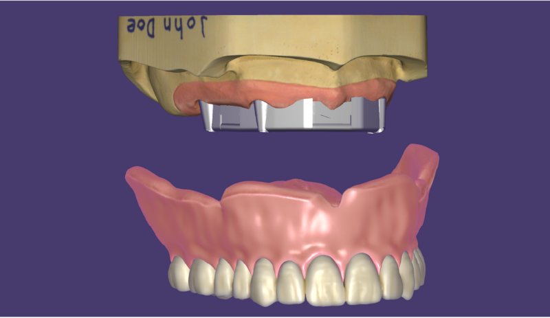File:RP4.png