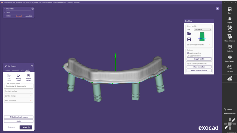 File:Split bar 3.3-14.png