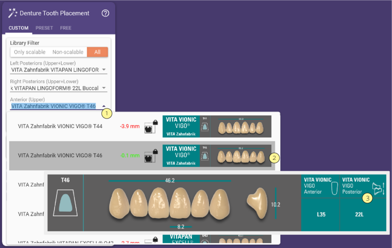 Denture Tooth Placement 1 3.2.png