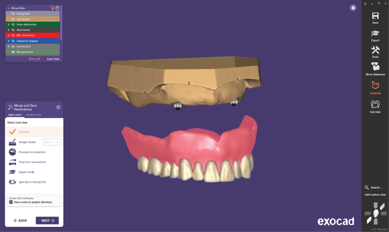 File:O ball attach 3.3-17.png