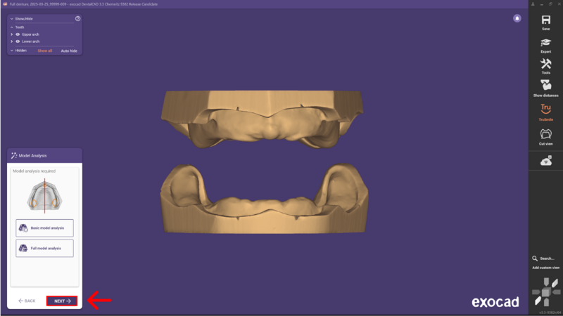 File:Denture remove teeth4-01 3.3.png