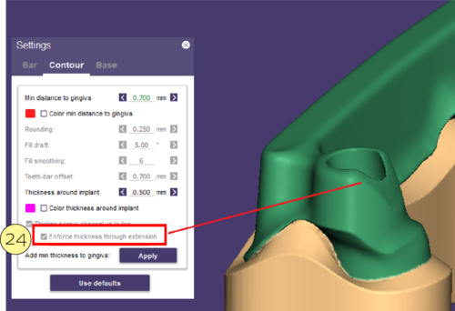 Split bar partial-22.png