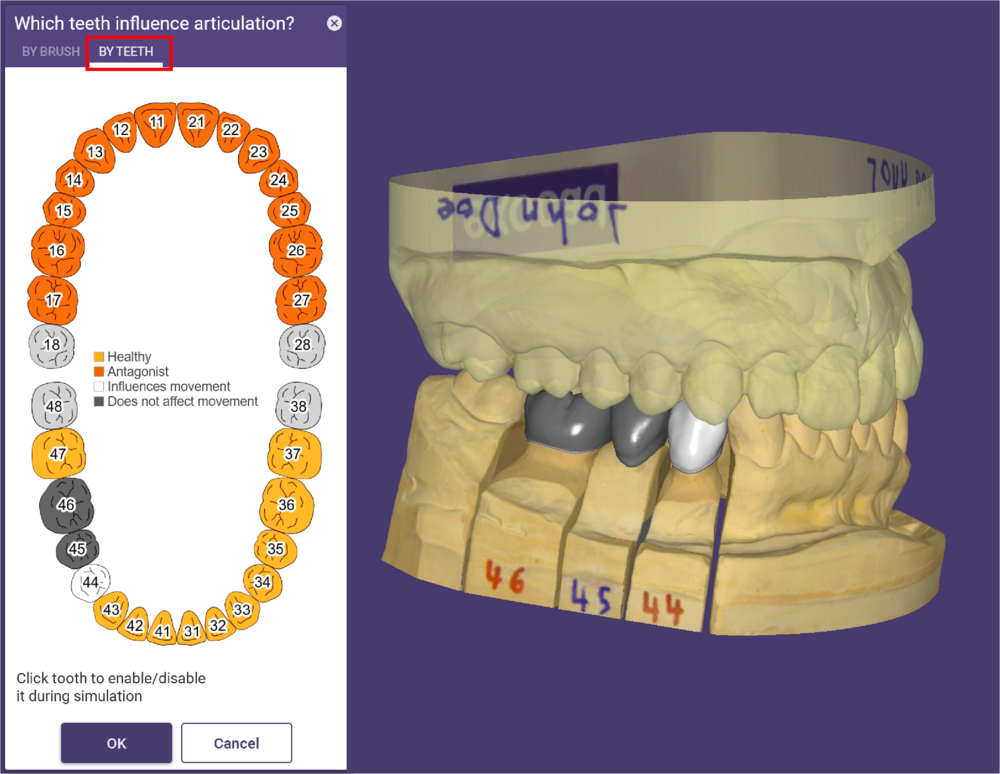 2 Virtual Articulator by teeth Galway 3.1.png