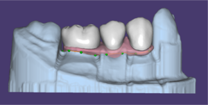 Gingiva base design 2.png