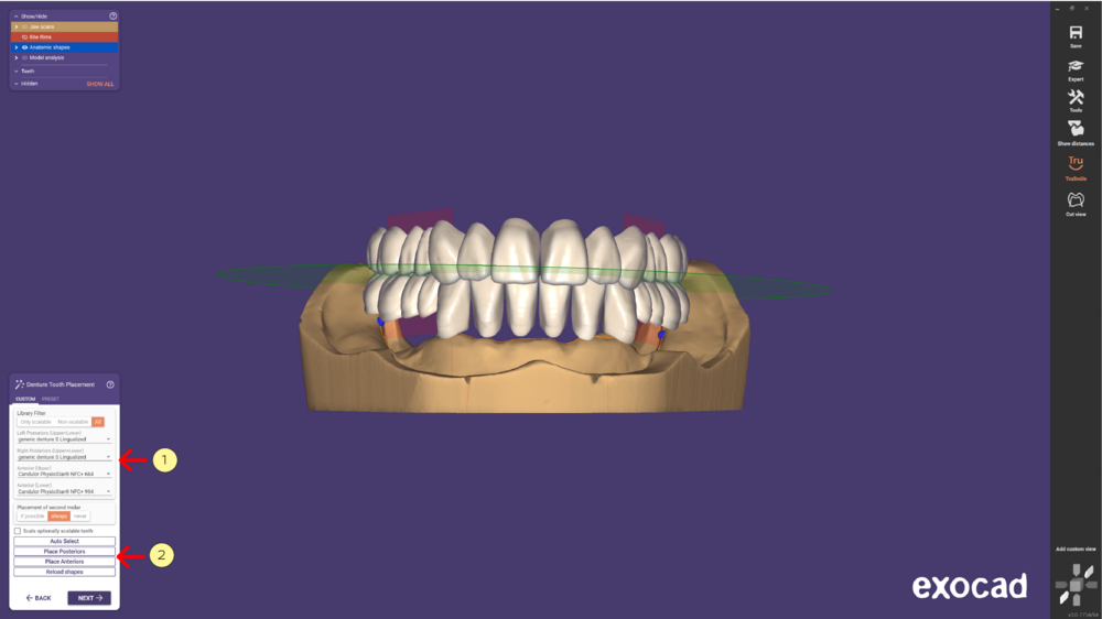 Denture remove teeth4-02.png