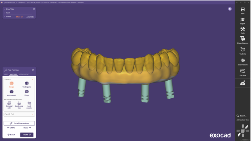 File:Split bar 3.3-18.png