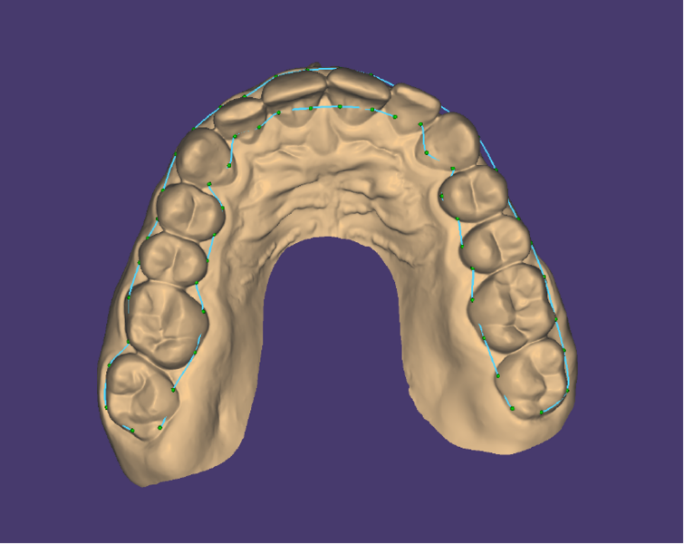 File:Bitesplint top 4.png
