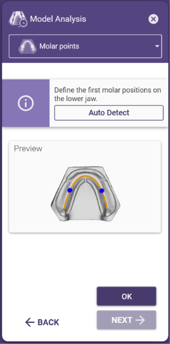 Model analysis first molar tooth.png
