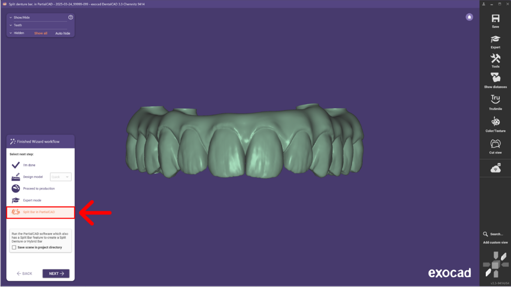 Split bar partial-03.png