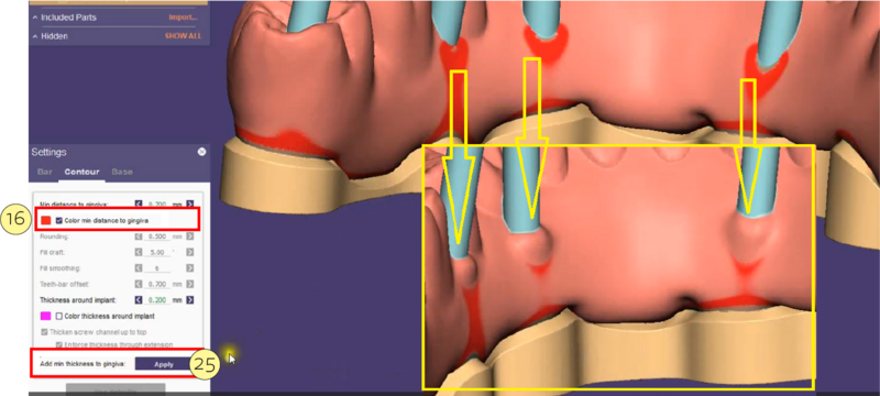 File:Split bar partial-20.png