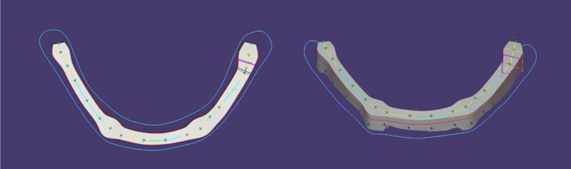 Split bar 3.3-08.png