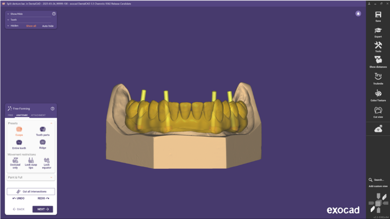 File:Split bar 3.3-04.png