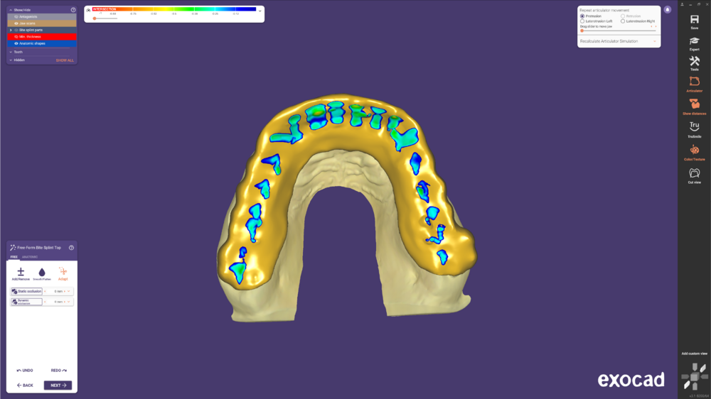 Design Bite splint antagonist and adjacent 3.1.PNG