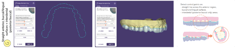 File:Bitesplint top G SR.png