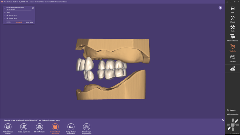File:Denture remove teeth4-07 3.3.png