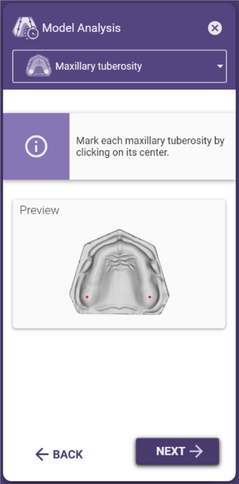Model analysis maxillary tuberosity.png