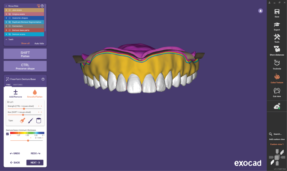 Duplicate denture3.3-12.png
