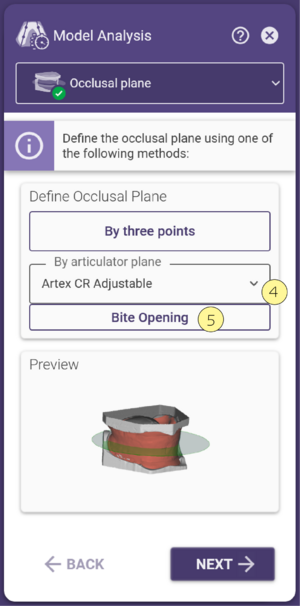 Define by articulator Bite opening.png
