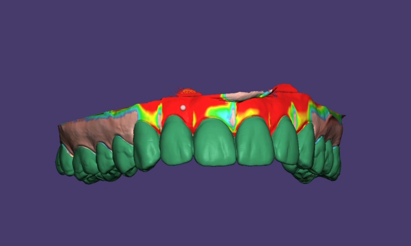 File:Snap-OnSmile.png