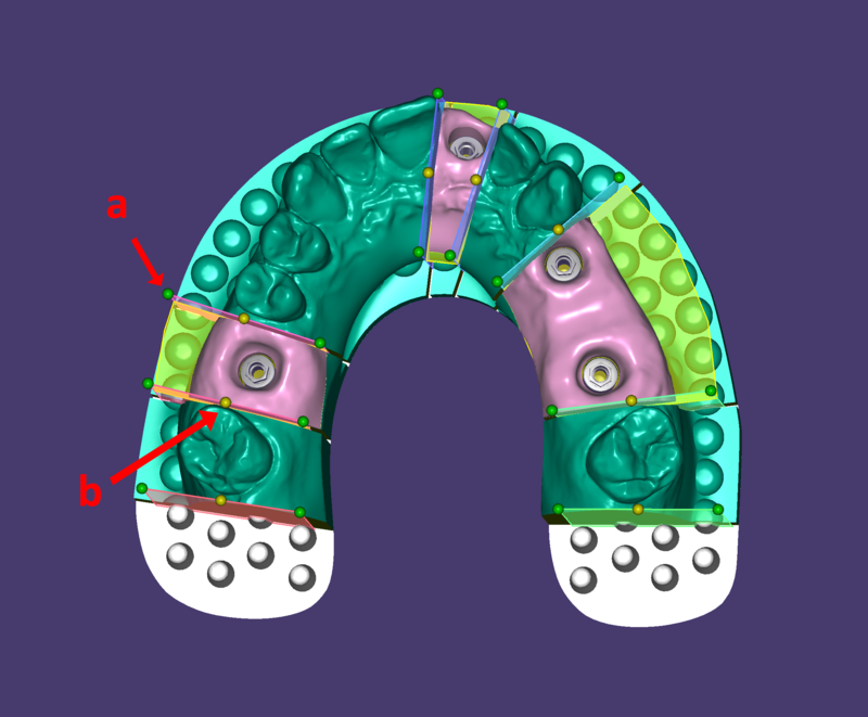 ImplantModelMovingPlane.png.png