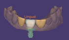 Tooth model placement