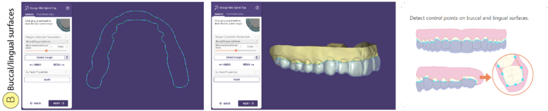 File:Bitesplint top B SR.png