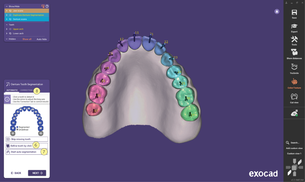 Duplicate denture3.3-07.png