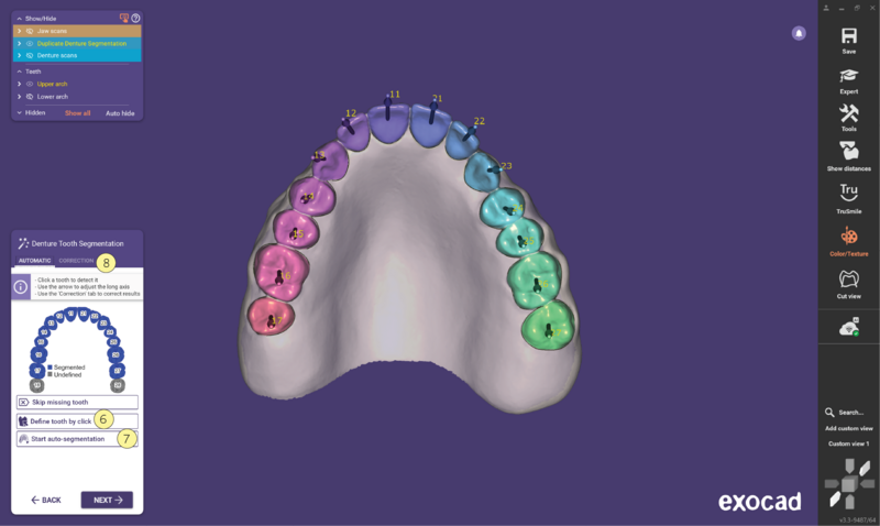 File:Duplicate denture3.3-07.png