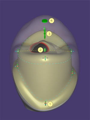 Abutment control 3.3.png