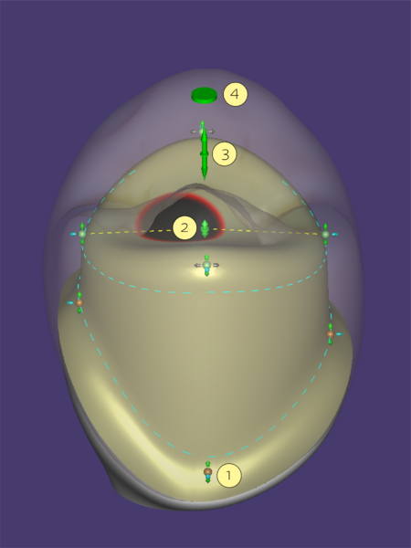 File:Abutment control 3.3.png