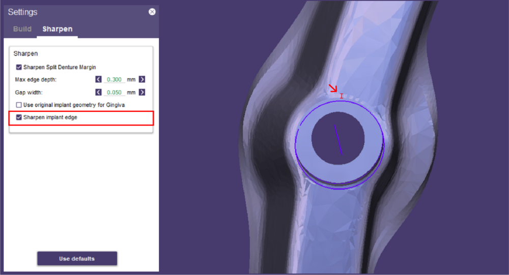Split bar partial-31.png