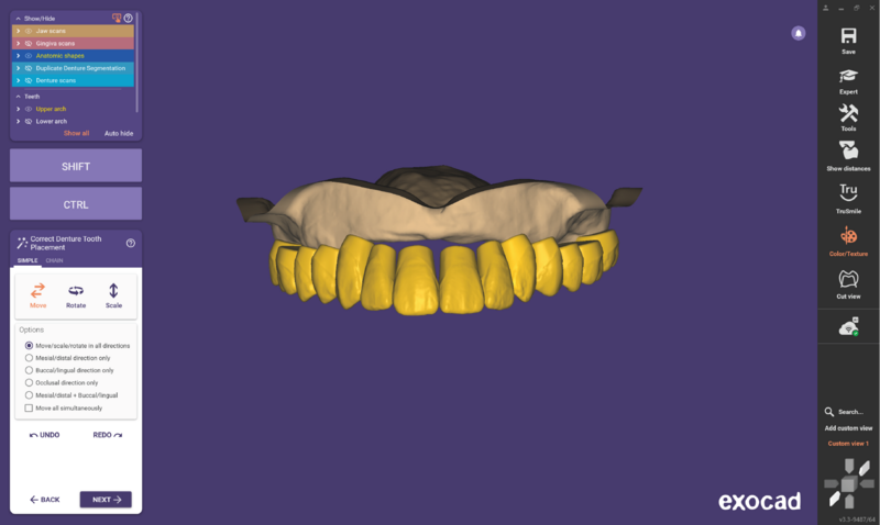 File:Duplicate denture3.3-08.png